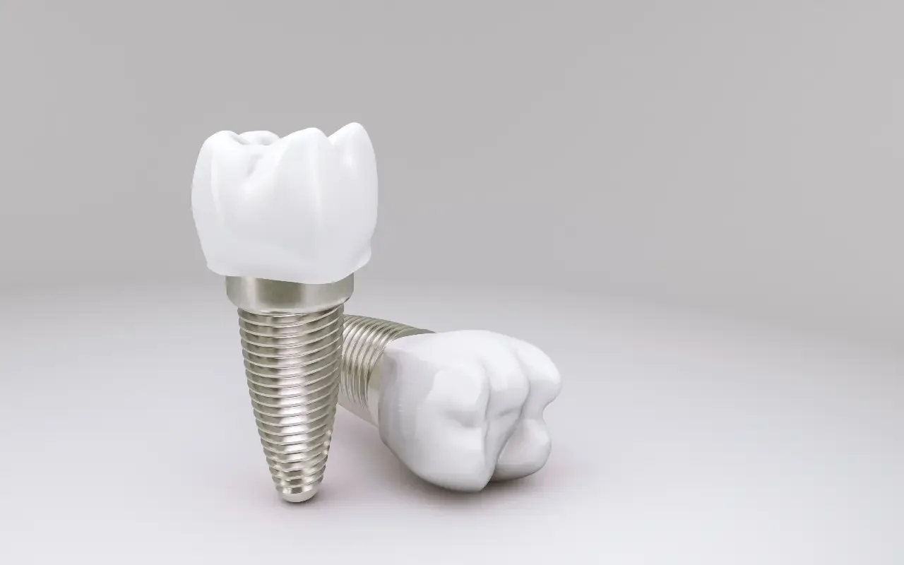 Dental implant